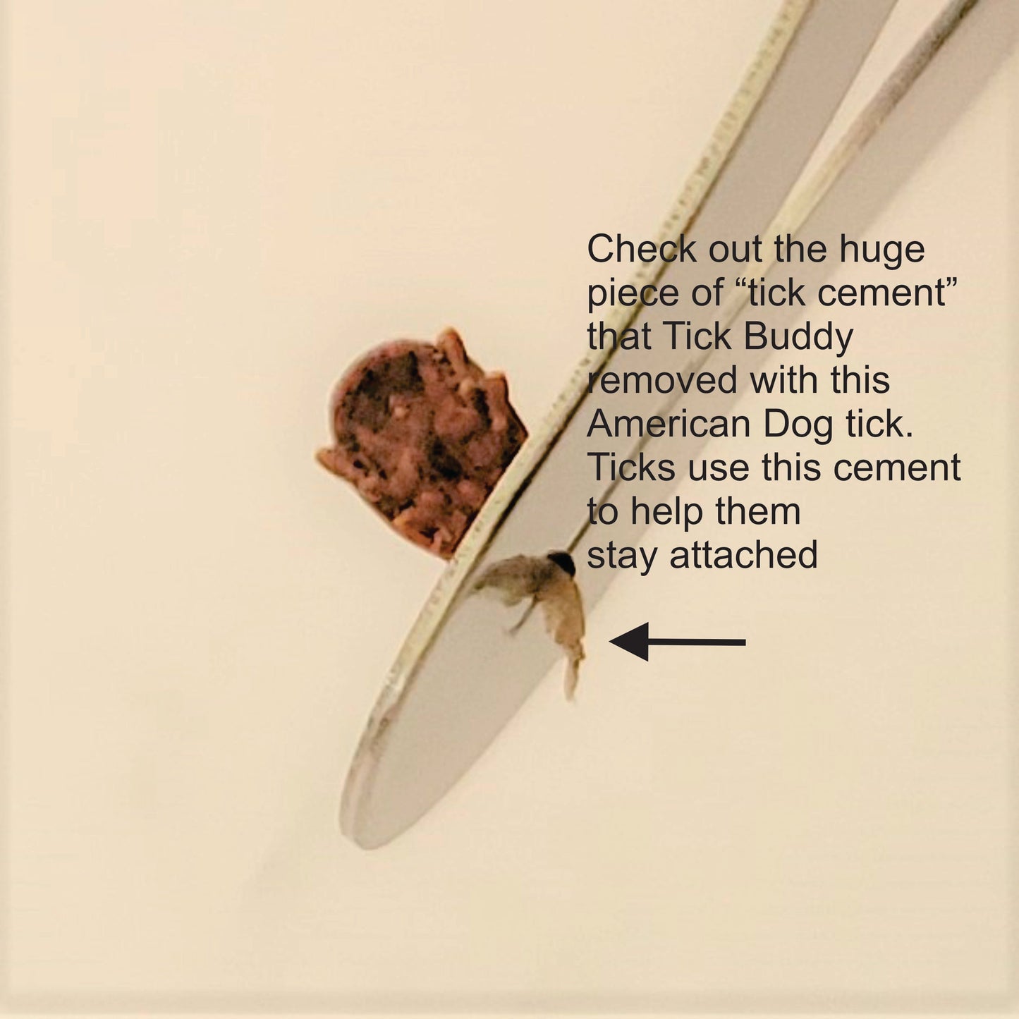 XDistributor - Tick Buddy Stainless Steel Tick Remover Tool - Minimum Order 60